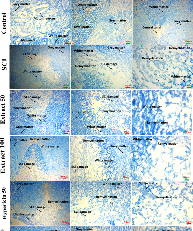 JournalSCI's tweet photo. "Hypericin exhibited strong neuroprotective properties by reducing oxidative stress, enhancing neurotrophic factor expression, and preserving myelin integrity in a preclinical model of SCI..."

https://t.co/L1AGWfgYTx https://t.co/qW9TPspEKs