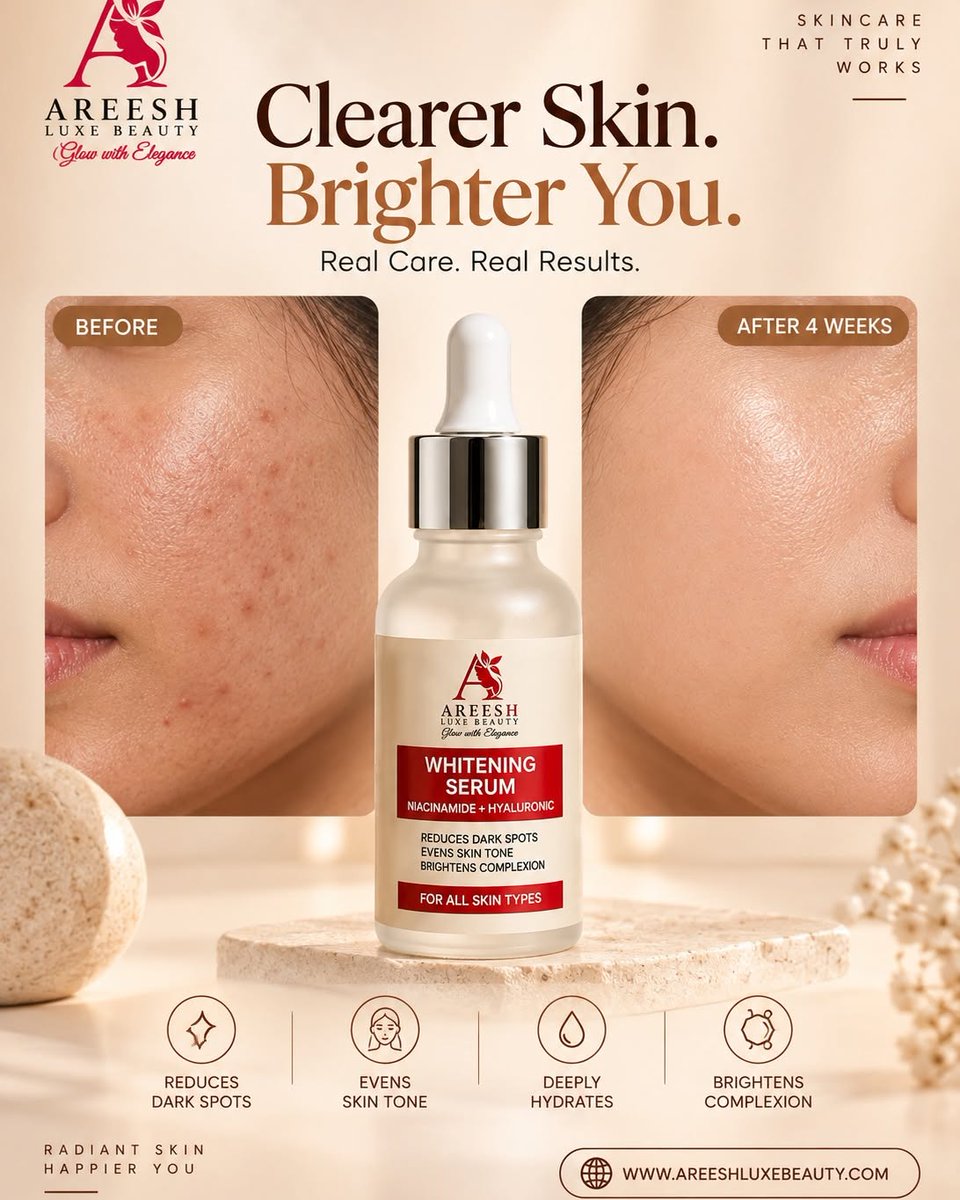 TequilaCoredlp's tweet photo. Clearer Skin. Brighter You. Areeesh Whitening Serum is lightweight daily care for dark spots, uneven skin tone, and dull skin. It helps reduce dark spots, even skin tone, deeply hydrate, and brighten the complexion. Try it for a radiant daily glow. https://t.co/JT5eMC71il