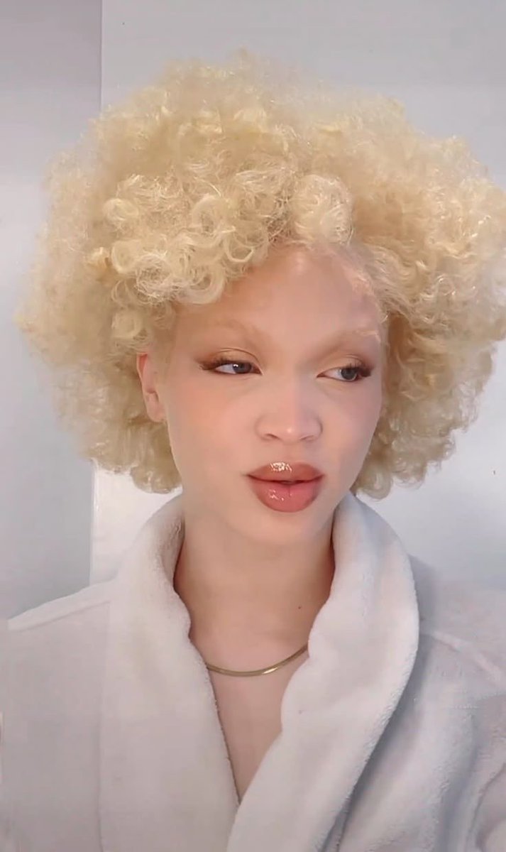 DollyComics's tweet photo. “Shai meadows isn’t black” 
Kiss my ass… she’s clearly a black girl with albinism… SHES HAS A CURLY FKING FRO FOR CRYING OUT LOUD…. AND BOX BRAIDS. 
“I picture her as white” who genuinely asked? This is a cut and dry conversation…. To pretend she isn’t black is just stupid💋 https://t.co/gYiv3AW9af