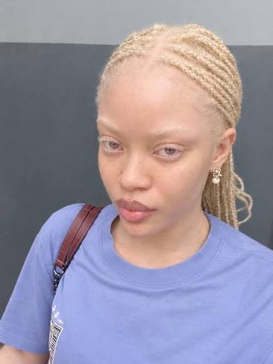 DollyComics's tweet photo. “Shai meadows isn’t black” 
Kiss my ass… she’s clearly a black girl with albinism… SHES HAS A CURLY FKING FRO FOR CRYING OUT LOUD…. AND BOX BRAIDS. 
“I picture her as white” who genuinely asked? This is a cut and dry conversation…. To pretend she isn’t black is just stupid💋 https://t.co/gYiv3AW9af