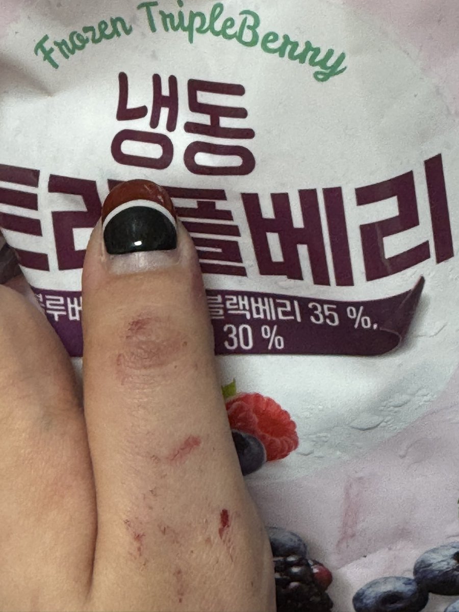 seoly_n_'s tweet photo. 냉동베리먹다가 엄마가 뭐 문서찍어보내래서 이 손 그대로 보냇는데 사람 묻엇냐고함 https://t.co/PTpAaqpkid