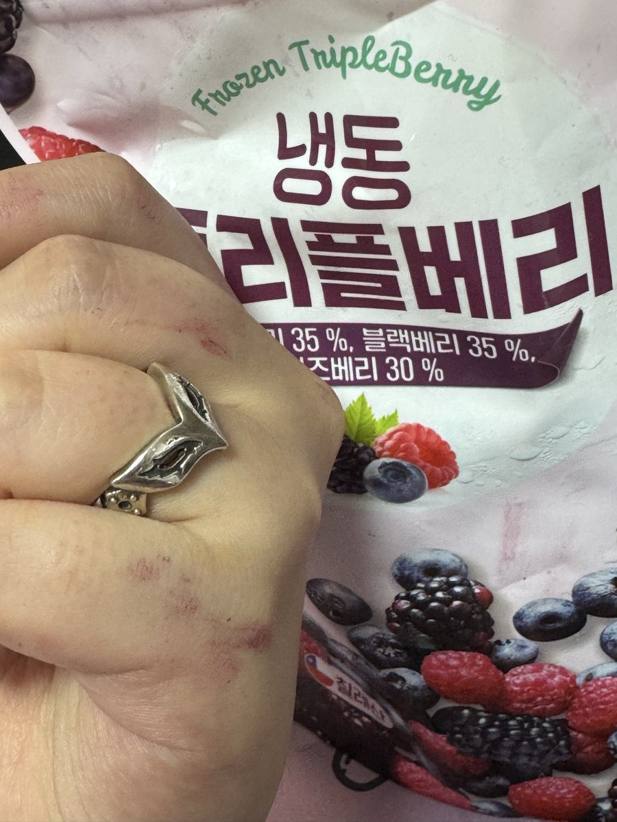seoly_n_'s tweet photo. 냉동베리먹다가 엄마가 뭐 문서찍어보내래서 이 손 그대로 보냇는데 사람 묻엇냐고함 https://t.co/PTpAaqpkid
