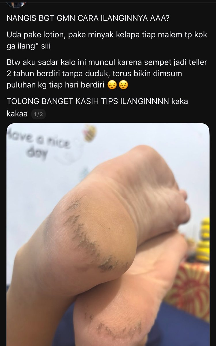 huhhh192's tweet photo. KA MAKASI UDAH BIKIN THREAD INI😭����🏼
Jadi tau solusi buat tumit pecah-pecah dan kasar cuma pakai 1 produk aja😭 https://t.co/mbh5vOBowi