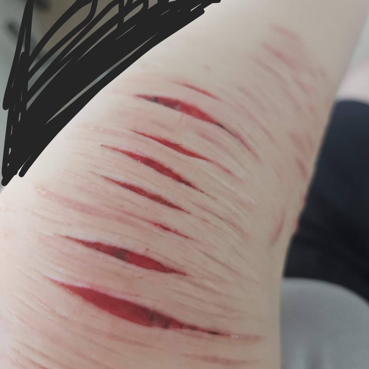 1doo_d's tweet photo. #자해 #sh

 예전거

Fake SFX makeup, all fake, not real https://t.co/VNjOTh2JXg
