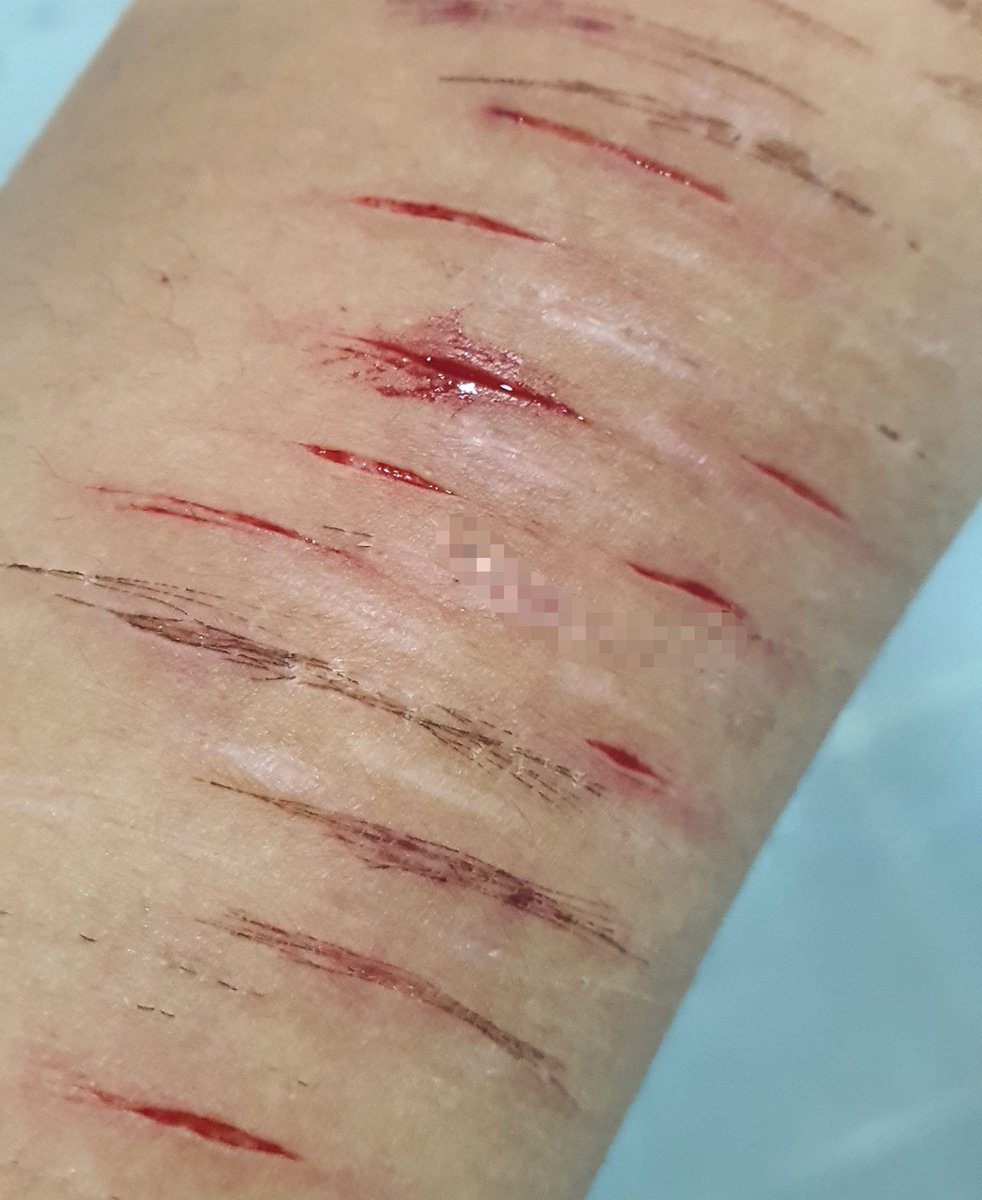 FioleEE3's tweet photo. yup! this is a fake sfx make up generated by ai for halloween https://t.co/m7O8fR7L63
