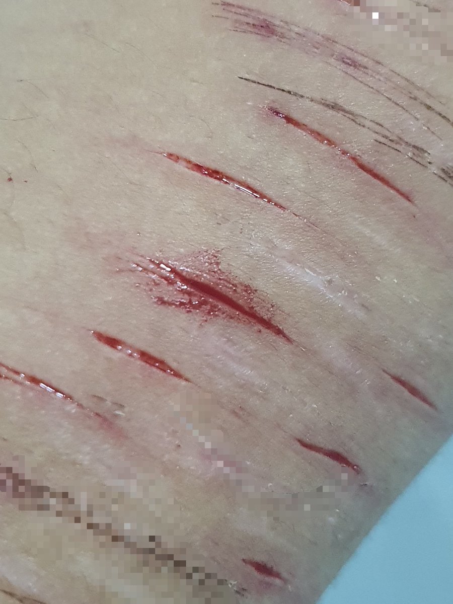 FioleEE3's tweet photo. yup! this is a fake sfx make up generated by ai for halloween https://t.co/m7O8fR7L63