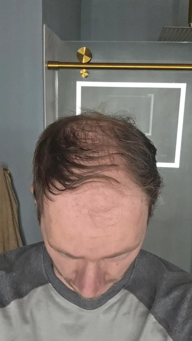 misot90's tweet photo. @YamperLover2 @_fcfcfc0__ The horse equivalent to a middle-aged dad with a comb over. https://t.co/gWKXQ9OVH0