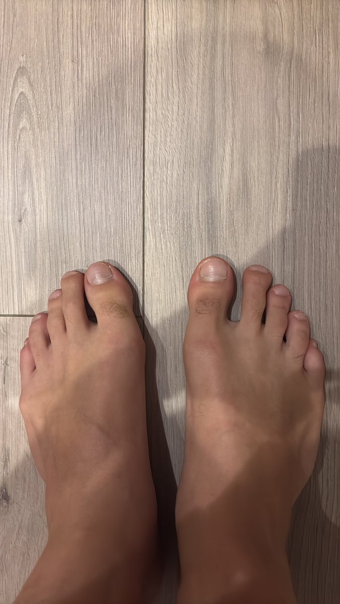 Dmas019015812's tweet photo. 🇮🇹 Quando guardi i miei piedi ti accorgi che non siamo della stessa specie! Inginocchiati e leccami i piedi!😮‍💨

🇬🇧 When you look at my feet, you'll realize we're not the same species! Get down on your knees and lick my feet!😮‍💨

#feetworshi̇p #piedi #findom @master_italiani https://t.co/yLeMXZyYEO