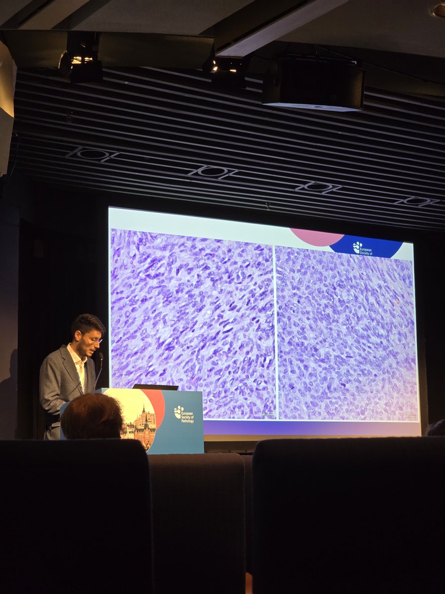 MolesSilvia's tweet photo. The last day of #ESPCongress had gorgeous and impressive mediastinal tumors. Always a pleasure seeing @AnjaRodenMD  sharing her extensive knowledge! https://t.co/GqkDplGdWC