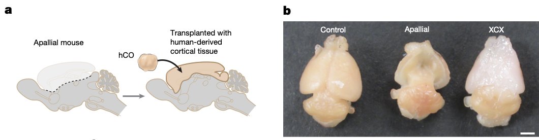 kevinwkelley's tweet photo. 1/ I have long dreamed of systems that could causally model human neurobiology across scales, from molecular to behavioral.

In @Nature, delighted to share our efforts at creating xenocortical mice where human organoids grow to occupy most of mouse cortex. https://t.co/qcjLLZHLTD
