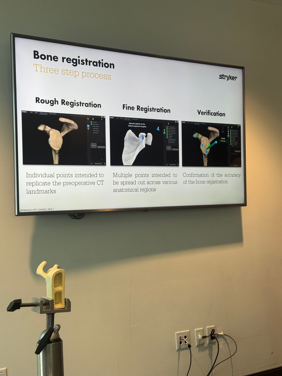 DrShrouderHenry's tweet photo. Dr. Jason Shrouder-Henry recently attended a seminar with Stryker focused on the latest advancements in robotic-assisted shoulder replacement.
He is committed to learning, advancing his expertise and bringing that knowledge back to his patients every day. 💙
#DrJasonShrouderHenry https://t.co/Z6Cge7SJRx