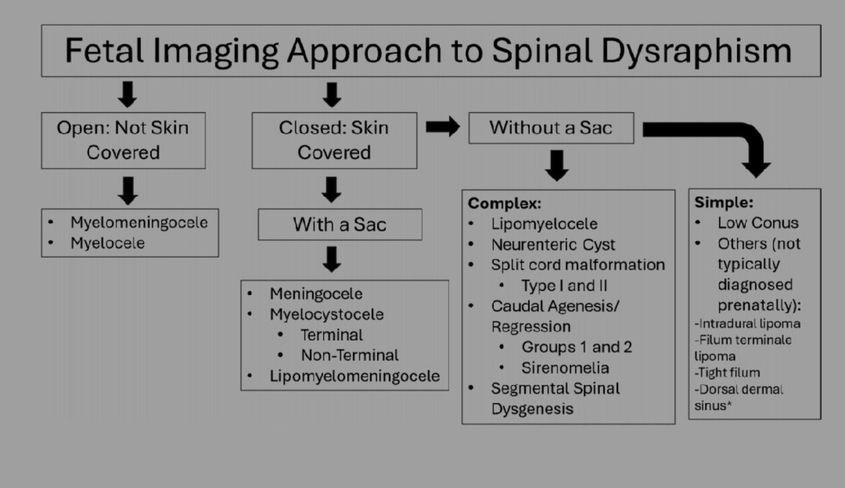 spinacademics's tweet photo. SPIN Tweetorial Wednesday | Fetal Spinal Dysraphism

A “low conus” sounds straightforward—until fetal development enters the equation.

The conus ascends during gestation, vertebral numbering is imperfect, and postnatal cutoffs cannot simply be applied to fetal imaging. https://t.co/ftrYxQ3KMy