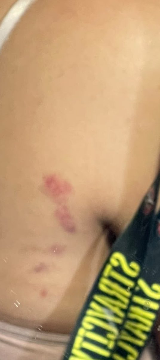 justgrislyx's tweet photo. Una stay de Córdoba mandó esto al grupo hoy:

"Hola chicas! Disculpen vengo a hacer un descargo ah yo estaba en campo delantero literal estaba a una sola persona de baranda,la pasé súper mal (no por que me descompuse) sino porque una señora me golpeaba, pellizcaba, me pateaba y tiraba del pelo, tengo un video en donde se ve justo cuando me da un codazo en la boca y asi incontables de veces, yo entiendo que la señora tenía early, pero cuando empezaron a saltar empujaban para adelante y quedé aplastada a la baranda a todo esto la mujer se enfureció más y sus pellizcones y codazos en la cara y costilla empeoraron
No saben cómo me cansé de llorar cuando termino todo pero bueno primer concierto y mala experiencia por esa mujer
Adjunto el video en donde me da el codazo en la cara y allí también se ve la cara de la mujer"

NO PODES SER TAN HIJA DE PUTAAAAAA OJALÁ ENCUENTREN A ESTA ESTÚPIDA. No sabes nada sobre los chicos y sobre respetar al resto