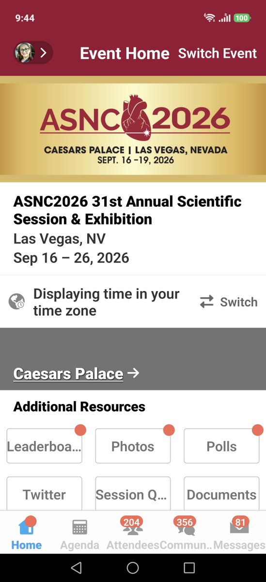estelais's tweet photo. #ASNC2026 Begins Today!!โจ
๐ 2:30pm PT Pre-conference Symposium: Optimizing F-18 PET MPI (additional register required)
๐ 5:30pm, Opening Reception+Rapid Fire Cases ๐ฅ ๐ฅ ๐ฅ #ThinkAmyloid #CVNuc @MyASNC https://t.co/FYftMwMSPg