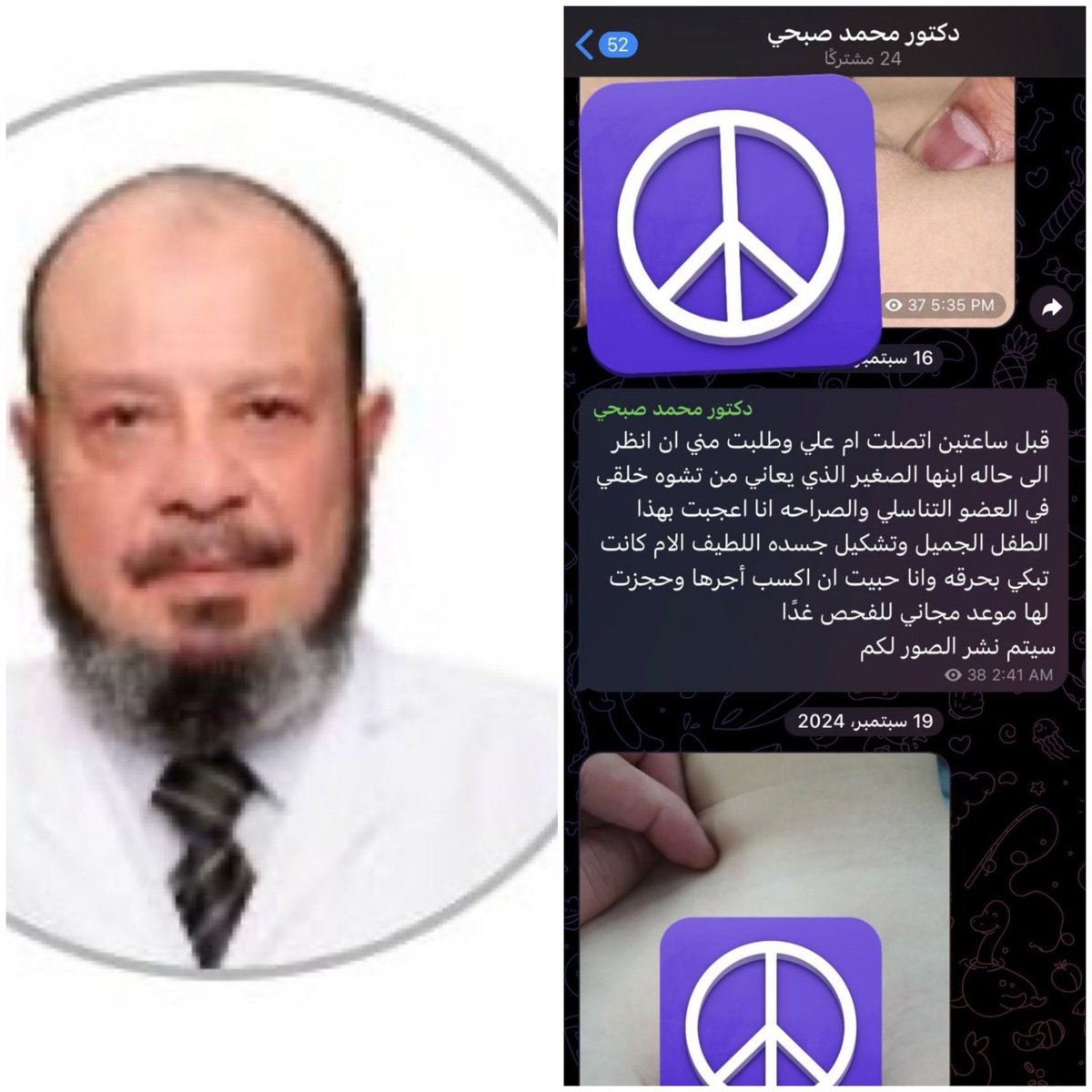 AClee0's tweet photo. غيض من فيض 

وظيفتين من أشرف المهن على وجه الأرض :

الصيدلة
والطب

- شوف تعامل الصيدلاني المصري
- وتعامل استشاري المسالك البولية المصري

~ مع محيطهم السعودي في حال كونه مريض أو زميل مهنة

عشان تكتشف إنهم أوسخ الفئات ويشتغلوا بشهادات مزورة وما تلاقي برأسهم إلا العفن الجنـ*_s_ـي https://t.co/2BUPHxXwOC