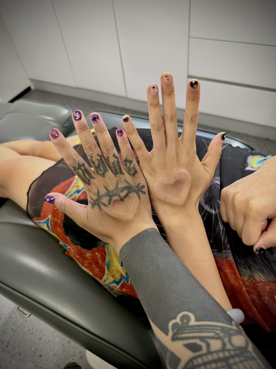 LitheCreator2's tweet photo. 恢复刚好一个月，效果太惊人了🥹

#bodymodifications 
#bodymodification 
#subdermalimplant 
#siliconeimplant 
#genitalbeading
#bodymods 
#bodymod 
#人体改造 
#硅胶植入 https://t.co/UTPNZfn81V