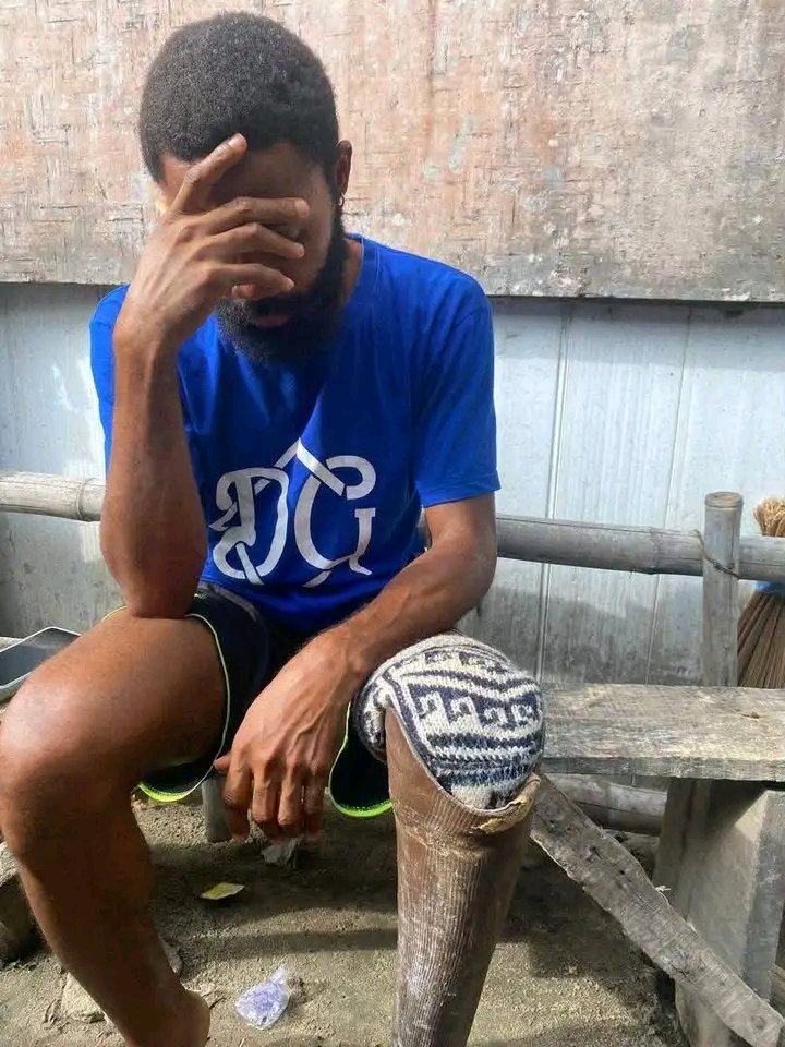 Emmanuelofnans's tweet photo. After losing his leg in a car accident, he was once too ashamed and shy to show his face online — he even covered it in his first post. 😂❤️

His wife, Anniebee, encouraged him to start sharing his story and stop hiding.

Today, he says: “I’m no longer hiding. I’m proud of who I am, and grateful to God for giving me the strength to keep going.”

From hiding his face to proudly telling his story. ❤️🙏

“All thanks to you, Anniebee.” 🥹❤️

#virałpost  #love