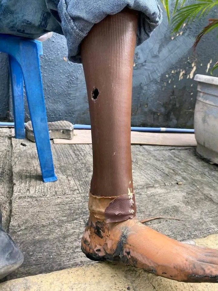 Emmanuelofnans's tweet photo. After losing his leg in a car accident, he was once too ashamed and shy to show his face online — he even covered it in his first post. 😂❤️

His wife, Anniebee, encouraged him to start sharing his story and stop hiding.

Today, he says: “I’m no longer hiding. I’m proud of who I am, and grateful to God for giving me the strength to keep going.”

From hiding his face to proudly telling his story. ❤️🙏

“All thanks to you, Anniebee.” 🥹❤️

#virałpost  #love