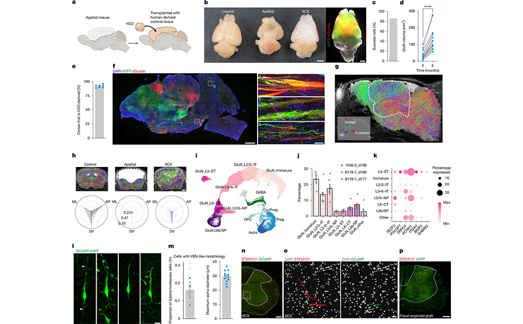 NaturePortfolio's tweet photo. A study in Nature demonstrates that human brain organoids transplanted into mice replicate some features of brain development, including the formation of functional neural networks that can support brain activity. https://t.co/D4YbVIqne5 https://t.co/B0wt88udiA