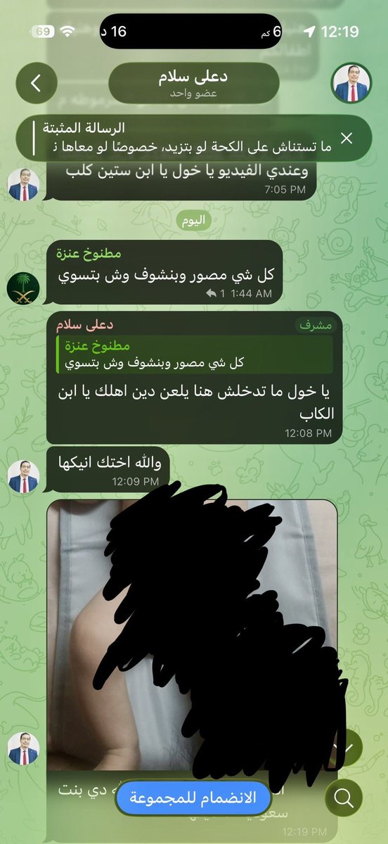 kld11010's tweet photo. ودك اللي مبتلى بقضايا قتل ومضاربات وكل يوم مبلش ربعه بالديات، يمسك مثل المصري القحبه ذا ويذكّيه في عيادته.
ثم يزرّق لوحة مخالفة ١٠ الاف في استه.
يقالك نظام وهيبة واحنا اللي نحمي العاملين في القطاع الصحي وهذه الكفاءات اللي يجيبونها كل سنه ويدفعون لهم مقابل الزناوه اللي قدامكم. https://t.co/few1nNgTyG