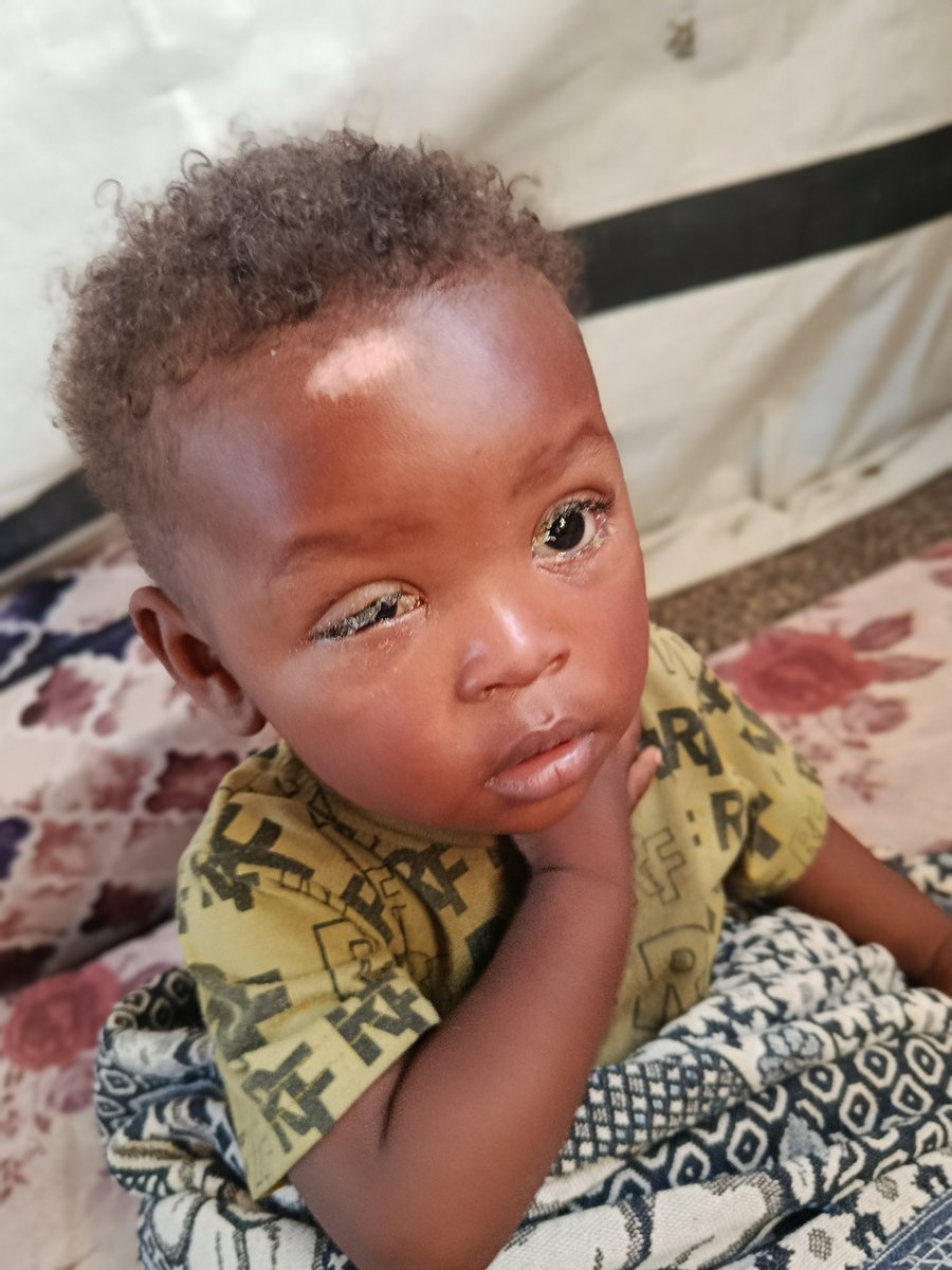 WafaaAman2001's tweet photo. Can you see my child? Can you feel his suffering? 💔
Please save my child. He is in pain. 🙏
Donate if you can, or please repost to help save him. ❤️‍🩹
https://t.co/y0CmxJ3Orp
@ll4gaza_ofcl @oliveegirl https://t.co/YozW9HOfib