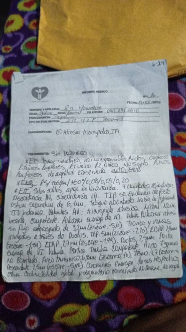Jesusfbolivarb's tweet photo. 🚨 SERVICIO PÚBLICO: La bebé Milagros Alcalá (5 meses) tiene una cardiopatía grave (Atresia Tricúspide) y requiere cirugía urgente. Le dicen no hacen esa operación en el sistema público.

Si puedes apoyar, comunícate con su mamá Yoleski Monsalve:
📞 0424-1366210

🔄 ¡Difunde! https://t.co/JLYB6EoVnV