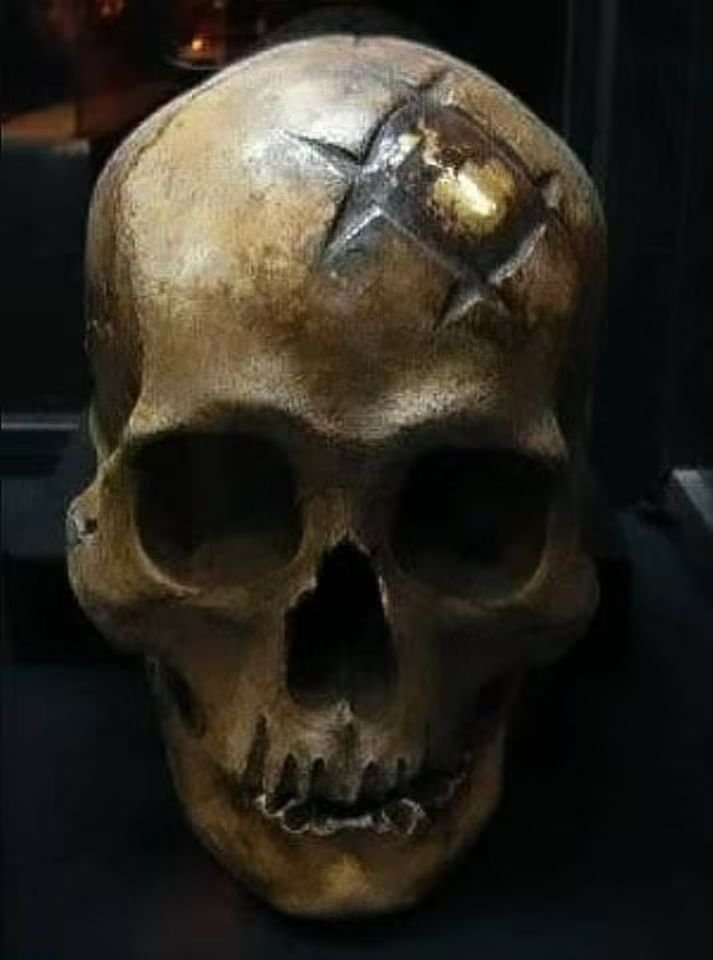EDICIONESREGION's tweet photo. El cráneo que están observando tiene unos 600 años...
Es un cráneo Inca.
Se encuentra en el museo Oro del Perú, Lima.

Lo que se observa en este cráneo es una cirugía ósea, llamada trepanación, en el que se usó como implante, una placa de Oro, y al parecer fue un éxito, porque muestra una clara reconstrucción ósea, y osteointegración, que significa que el paciente vivió lo suficiente para que el Oro se adhiriera al hueso como algo natural...

Mundo Desconocido