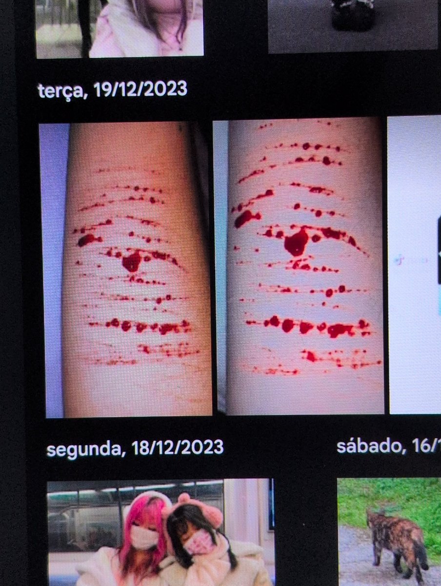 LostGall's tweet photo. And to think all my scars are gone, kinda miss them https://t.co/JSwvMFZ6Fe