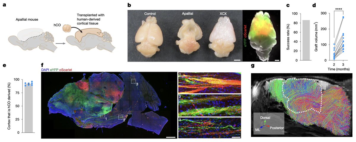 Dr_Alex_Crimi's tweet photo. #brain stuff 🧠:
Historical day, @kevinwkelley and colleagues created a xenocortical mice where human organoids grow to occupy most of mouse cortex https://t.co/tx4YwiestN https://t.co/gx9AGBfa96