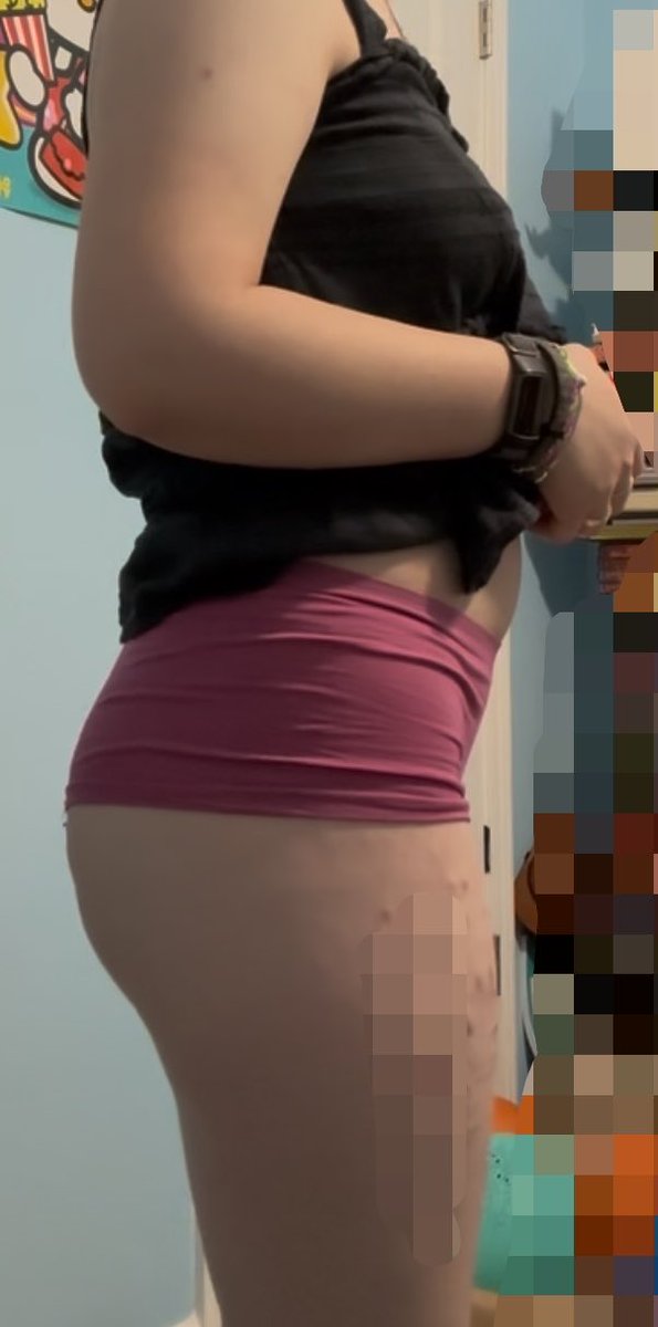 secretskatebtl's tweet photo. found old bodychecks
bmi 18 (now) vs bmi 23 ish (then)
#comparisonspo #edrtwt #bodycheck https://t.co/sCQRuH4AfO