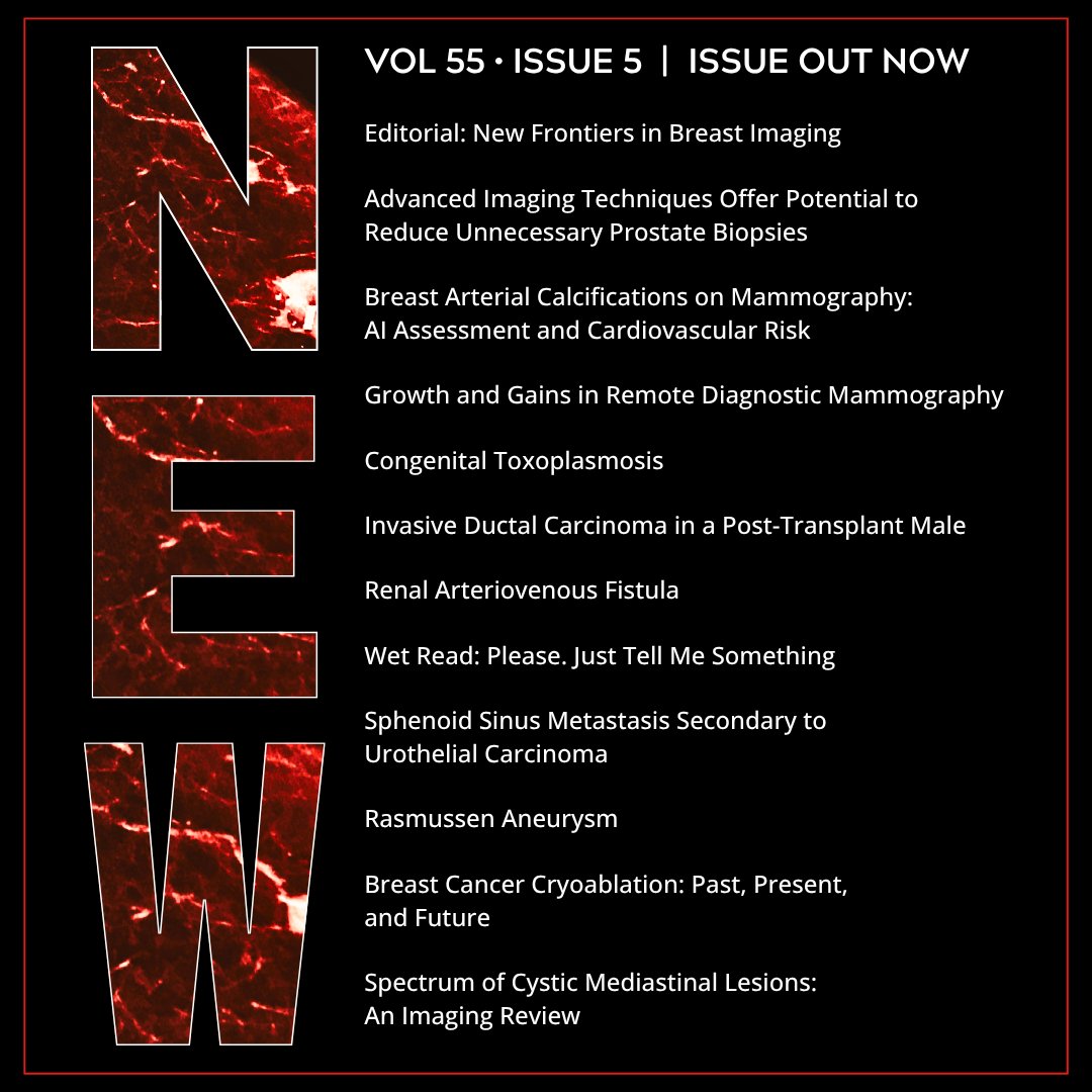 Applied_Rad's tweet photo. 🚀 New issue out now!

1 x New Editorial
1 x New Wet Read
2 x New Review Articles
2 x Articles
4 x New Case Studies

Check it all out: https://t.co/ynyiT0KUk0 
 
#Radiology #Imaging #Radiologist #MedicalImaging #AIinRadiology #AI #CaseStudy #RadEd #MedEd #Mammo #Mammography https://t.co/p3nS3tVLzt
