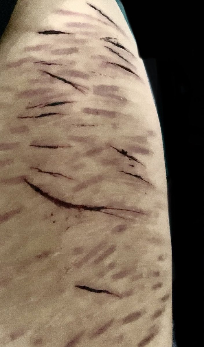LifeinMarss_'s tweet photo. Sfx makeup
I really don’t feel good,I haven’t for some months since my last attempt and I don’t think I’ll get better, I don’t even feel real and I think my time is coming soon, my life is falling apart, sorry 
#shedrtwt #slittwt https://t.co/fzq8MsxWoM