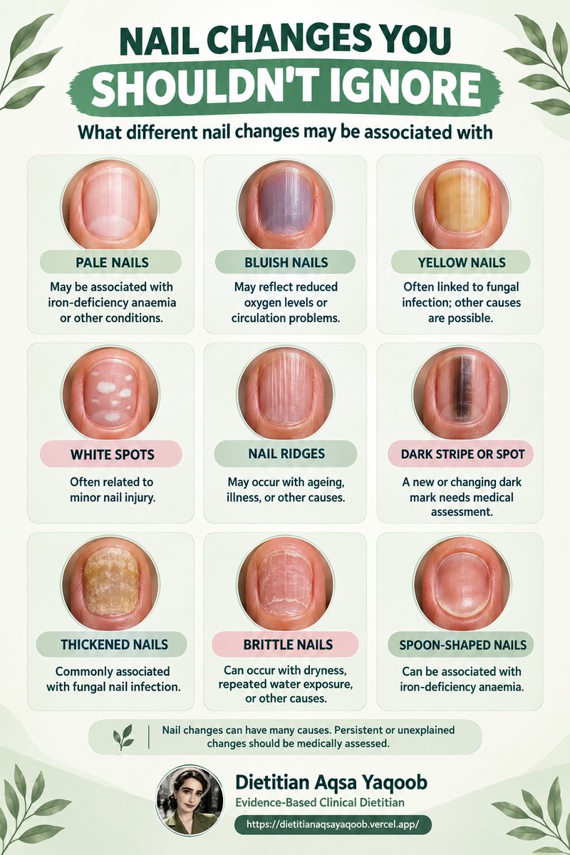 hello_aqsa's tweet photo. #NailHealth #NailChanges #HealthyNails #fyp #DietitianAqsaYaqoob https://t.co/Jc584zRM9v