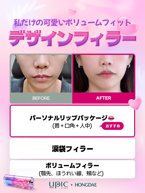 Upic_jp's tweet photo. 弘大店おすすめ♡BEST 施術まとめ♡

💕「もっと可愛くなりたい」を叶える✨

弘大店おすすめ♡ Beauty Charging💎

「なんとなく物足りない…」そんなお悩みをUPICクリニック弘大店が全力サポート🪄

💗 へこんだ部分に自然なボリューム感を
→ デザインフィラー

✨ 肌の調子を上げたいなら
→ 再生肌管理

💎 弾力のあるすっきりVラインへ
→ リフティングレーザー

韓国美容で、自分らしい「可愛い」をもっと楽しもう🇰🇷💕

気になる施術がある方は、
公式LINEからお気軽にお問い合わせ・ご予約ください📩💗

#UPIC #kbeauty #韓国美容 #プチ #UPICCLINIC #韓国皮膚科 #UPICクリニック #ソウル美容 #弘大皮膚科 #弘大美容 #韓国肌管理 #フィラー #肌管理 #リフティング #Vライン