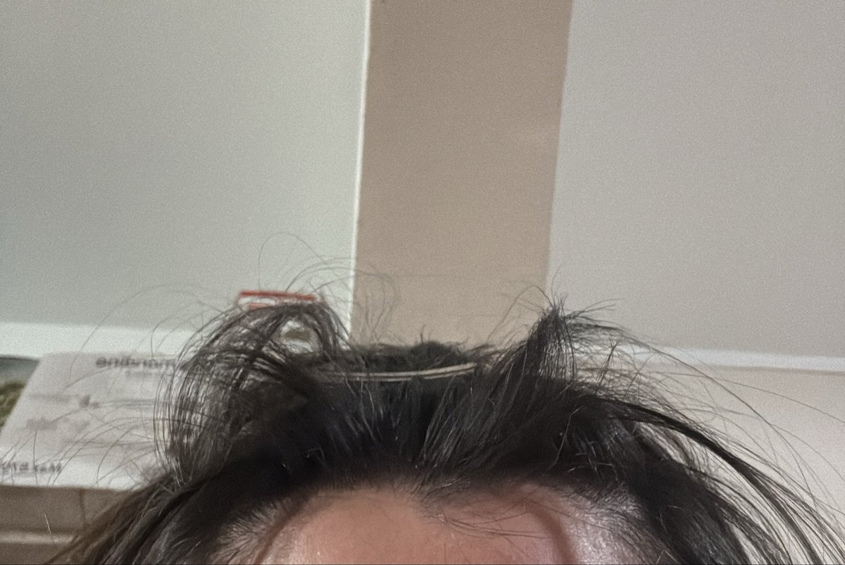 Ak4Tiki's tweet photo. tengo el flequillo tan corto que no me lo puedo hacer https://t.co/vOOrkhw4A9