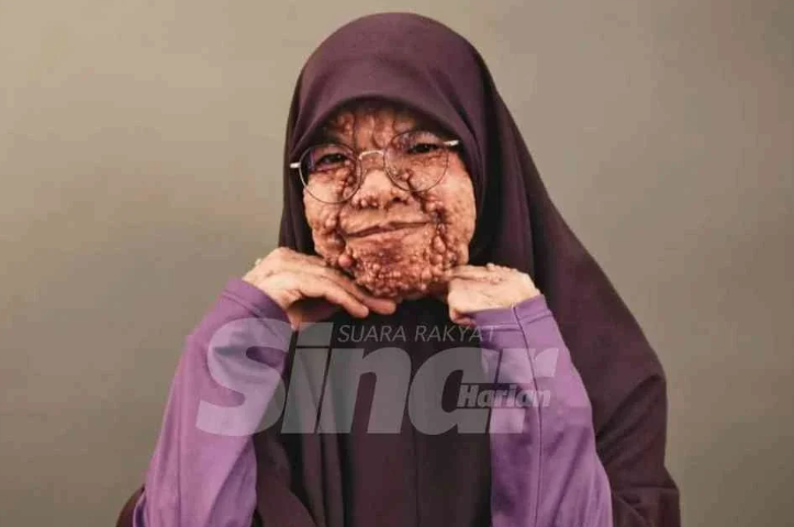 SinarOnline's tweet photo. 'Doktor cakap sudah terlambat'

"Ada yang tanya, saya tak malu ke? Saya jawab, apa yang saya nak malukan kerana ujian ini hadiah daripada ALLAH..."

BACA: https://t.co/aHcLUv6owo

#sinarharian #beritaterkini #beritaviral