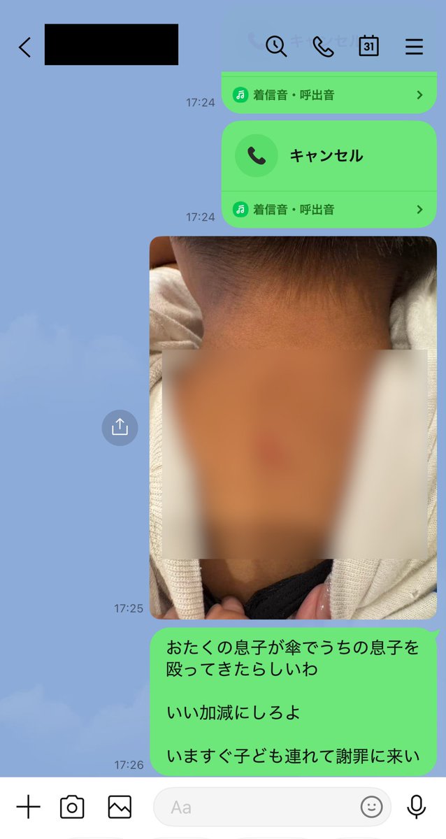 takami_seiji's tweet photo. 息子が下校中に同級生からカサで殴られた。

すぐ相手の父親と母親に連絡した。

でも既読にもならない。

返信もない。

実はこれが初めてじゃない。

1年前にも同じ子から腹を殴られ
学校を巻き込んで問題になっている。

当時は相手の長男が同じ少年野球にいて
父親もコーチだった。

今後の関係もあったから
こちらも多少は飲み込んだ。

だけどもう状況は違う。

何より一度問題になったのに
また息子に手を出した。

親としてここは絶対に曖昧にしない。

何があったのか事実確認し
学校や教育委員会にも伝え
必要な対応を一つずつやる。

子ども同士だから。

よくあることだから。

そんな言葉で終わらせるつもりもない。

一度は飲み込んだ。

でも二度目はない。

親として息子を守るために
今回は最後まできちんと対応する。
