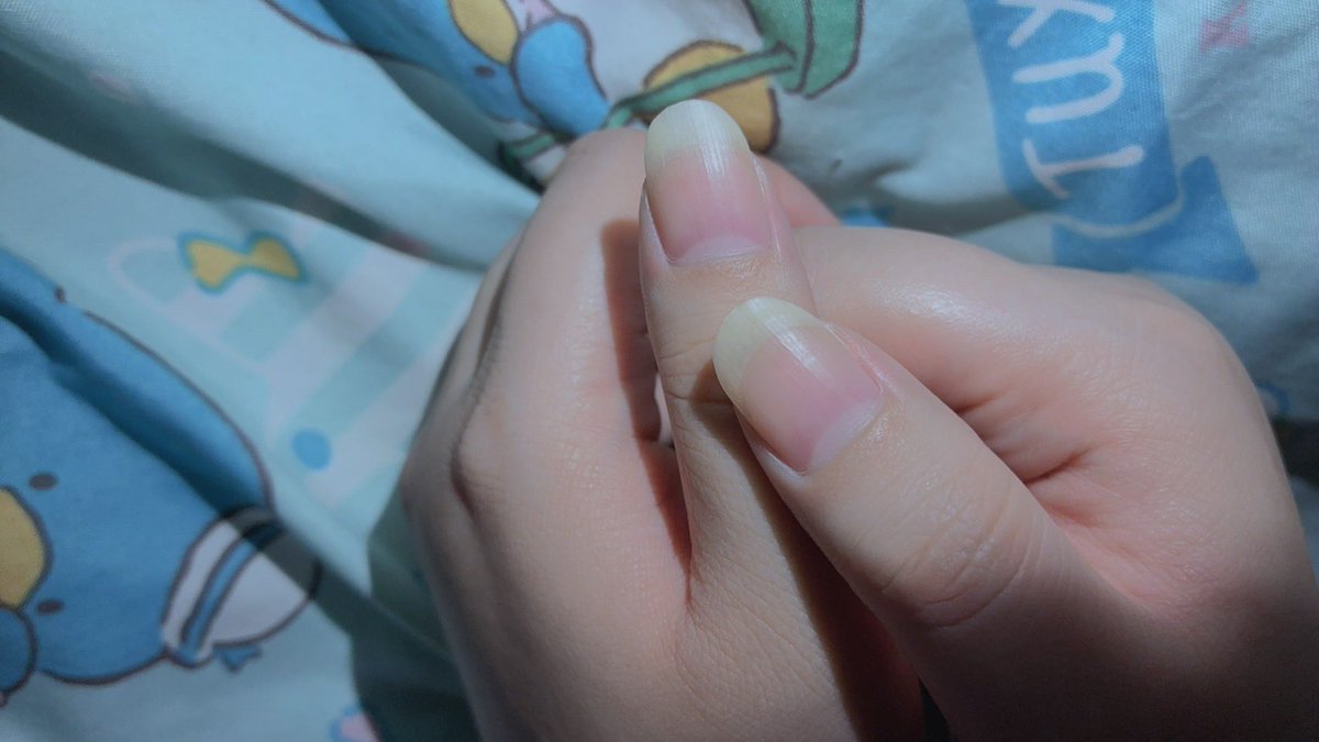 S__ake_'s tweet photo. そんなことより、どちゃ綺麗だと思わないか？
自己満だけど(っ`•ω•´c) https://t.co/8Y586hcAZJ