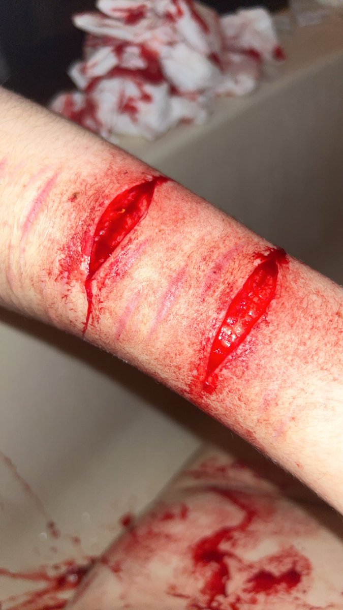 bloodydcs's tweet photo. cool fake sfx makeup not real injury practice for halloween costume completely fake fake fake not real #988twt #shrtwt #slittwt #beans https://t.co/s3HSA5zcn0