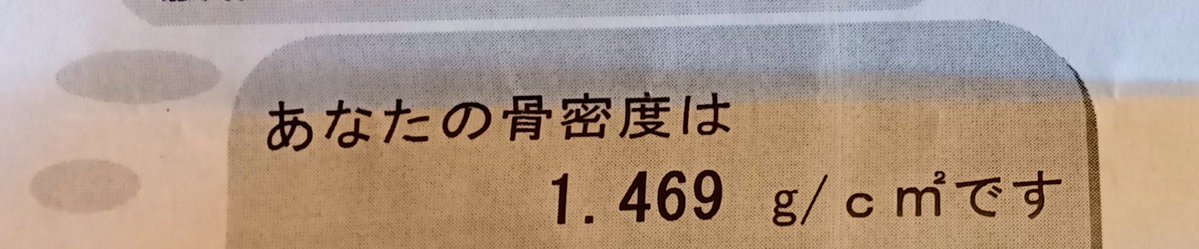 bornite_rainbow's tweet photo. 観念して整形に行った結果、骨密度は恐ろしく優秀なのに、この歳にして背中の椎間板は損傷してるわ膝はやられてるわで、4年間チートデイ以外は韓流アイドル的減量をしたのにトレードオフになってしまう。身体が曲げれないからレントゲンも腕の筋トレしてて良かったって位にキツい体勢を強いられるw https://t.co/I8bm4YPfRn