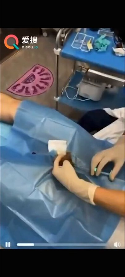 andersondiego14's tweet photo. 网传男星王鹤棣做丁丁手术失败导致阳痿 

王鹤棣手术失败曝光？！！ https://t.co/Vdzpe8bhK0