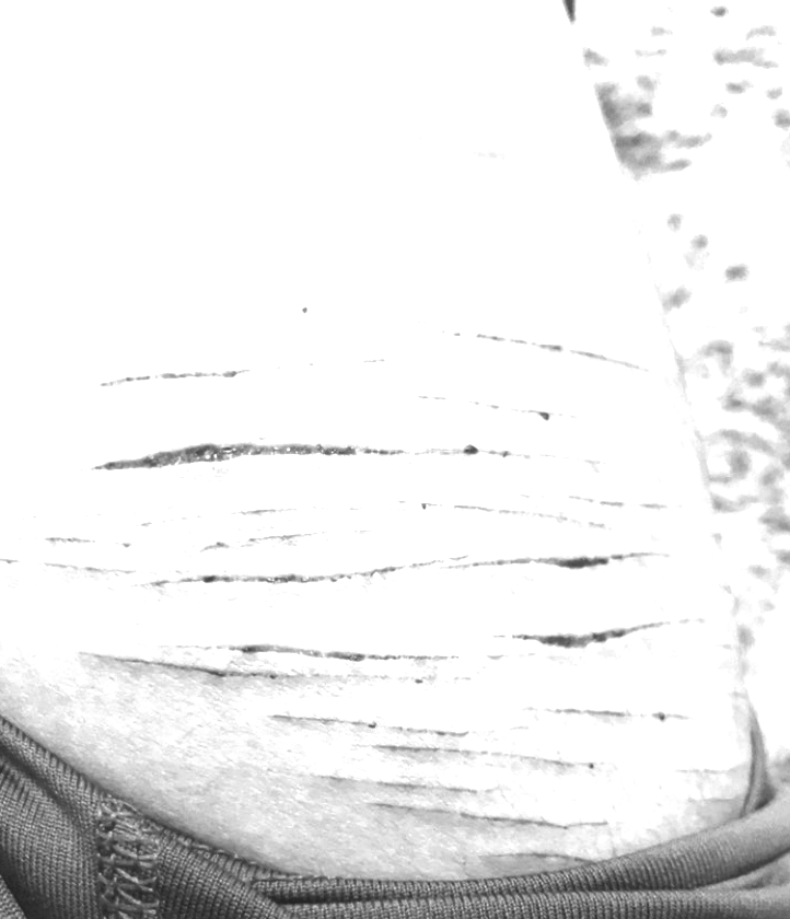 Nolixity's tweet photo. my MAKEUP as an SFX ARTIST still looks fresh FAKE #slittwt #shedrtwt #shrtwt https://t.co/nBAG4oR0FB