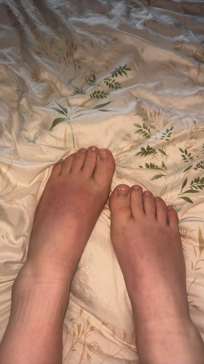 QueenyAmberXo's tweet photo. Fresh pedi need, soft soles… seemed rude not to share 🤍
What colour should I get next? 👣
#FeetTwitter #SoleSunday #PrettyFeet https://t.co/rama4HmMgM