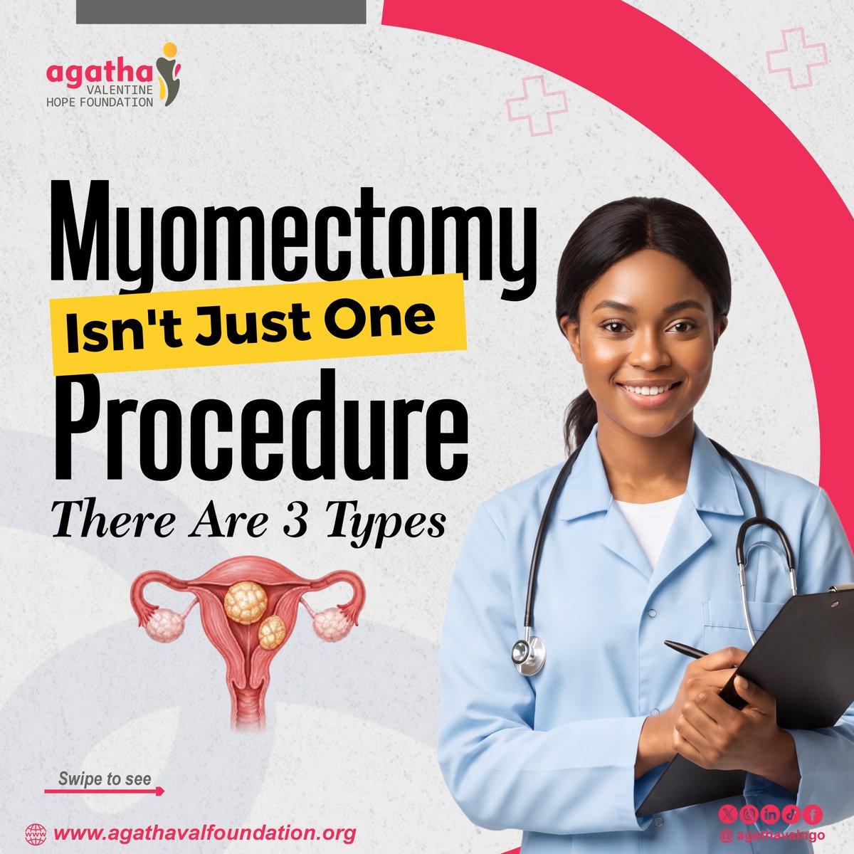 agathavalngo's tweet photo. Myomectomy is not a one-size-fits-all surgery. And this is something every woman dealing with fibroids deserves to know.

There are different types of myomectomy, and the option considered for you can depend on different factors.

Batistuta TG Omori #glowelcomebonus Subsidy Umahi https://t.co/QLncfurGEP