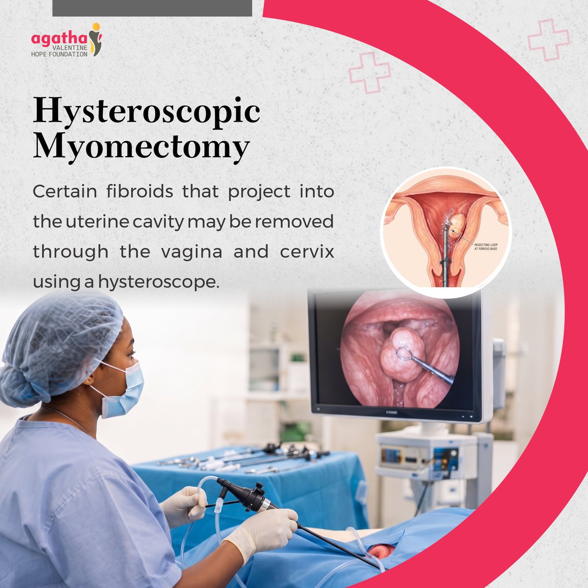 agathavalngo's tweet photo. Myomectomy is not a one-size-fits-all surgery. And this is something every woman dealing with fibroids deserves to know.

There are different types of myomectomy, and the option considered for you can depend on different factors.

Batistuta TG Omori #glowelcomebonus Subsidy Umahi https://t.co/QLncfurGEP