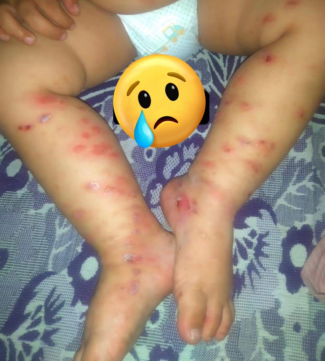 rola_almoghrabi's tweet photo. MY CHILD IS DYING😭

︎
︎

︎

︎

︎

︎
︎

︎

︎

︎

we’ll remind you
︎

︎

︎

︎

︎
︎

︎

︎

︎

︎
︎

︎
︎

︎
︎

︎

︎

︎

︎
︎

︎

︎

︎
that
︎

︎

︎

︎

︎

︎
︎

︎

︎

I desperately need TREATMENT for my baby🍼
https://t.co/FLk3iM7URh https://t.co/MlZSxBmvjB