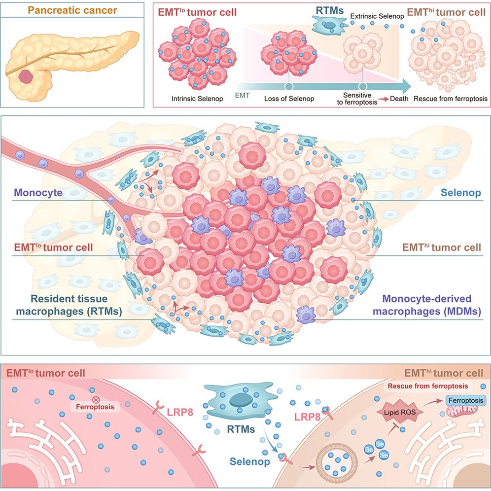 LukensJohnR's tweet photo. Resident tissue macrophages transfer selenium transporter protein to protect pancreatic cancer from ferroptosis: @CellCellPress  https://t.co/eH632dvQDA https://t.co/JqP8CRej5e