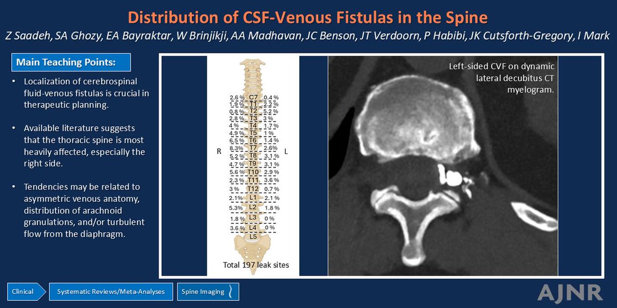 TheAJNR's tweet photo. "Occurrence of CSF-Venous Fistulas by Spinal Level and Laterality"

https://t.co/QoRy4cTojC https://t.co/jS0KxtGuyO