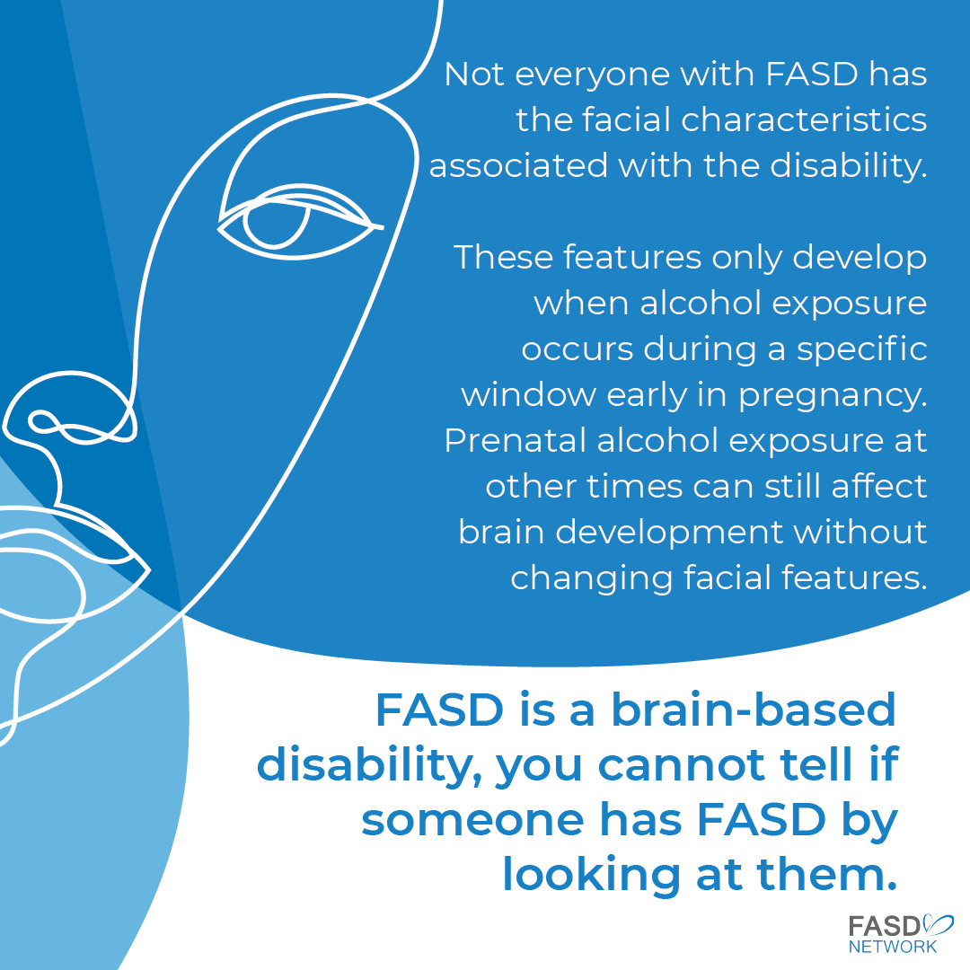 SaskFASDNetwork's tweet photo. While some people with FASD may have specific facial characteristics, most do not. This can contribute to FASD being misunderstood or overlooked, especially when people expect a disability to be visible. https://t.co/WM1Vsvkjv3