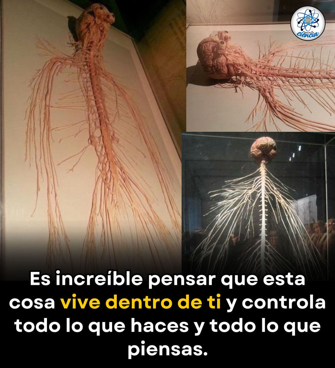 EnsedeCiencia's tweet photo. Debajo de tu armadura de carne y hueso, esta es tu verdadera forma: la red que te permite sentir, pensar y existir. 🧠 https://t.co/ndxPWGqQow
